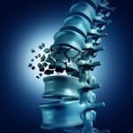 Vertebroplastia e Cifoplastia