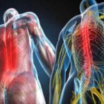 Perguntas frequentes e causas das dores nas costas