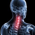 Conheça as causas e o tratamento para dor no pescoço