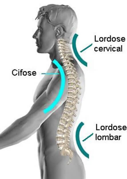 lordose lombar lordose cervical