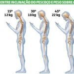 Dicas para evitar lesões na coluna devido ao uso do smartphone