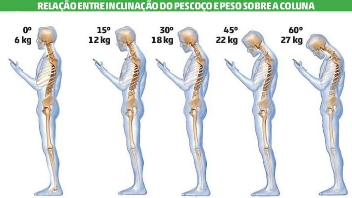 Problemas na coluna vertebral: cuidado com movimentos ao arrumar a