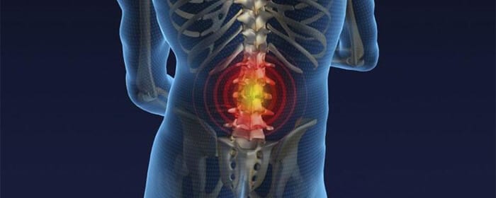 Como identificar se sua dor na perna é causada por um problema na coluna