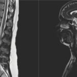 Procedimentos e exames clínicos ajudam a diagnosticar problemas de coluna