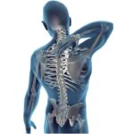Dor irradiada da coluna: problemas nas costas podem causar sintomas em outras regiões