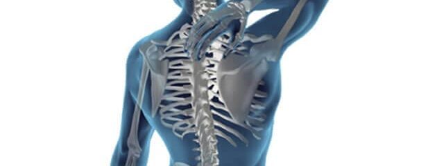 Dor irradiada da coluna: problemas nas costas podem causar sintomas em outras regiões
