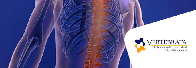 Terapia de Infusão Espinhal: 3 indicações para tratar dores na coluna