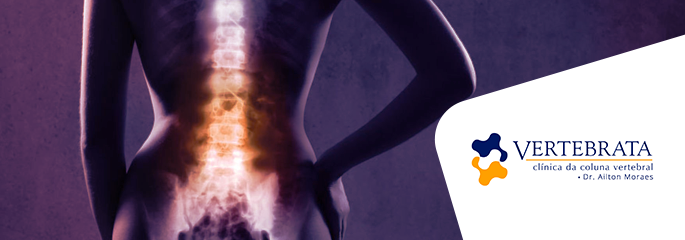 Mitos e verdades sobre a coluna vertebral