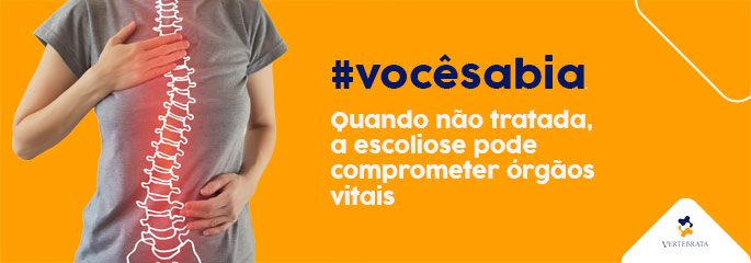 Não deixe que te digam que você não pode! - Projeto Escoliose