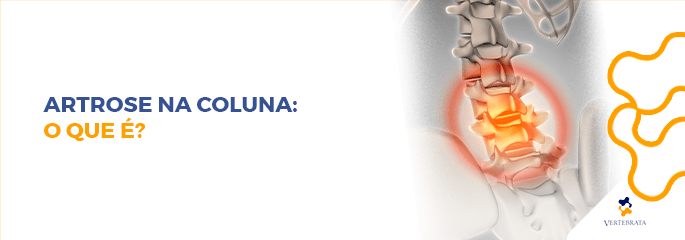 Artrose na coluna: O que é?