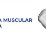 Contratura muscular e lombalgia