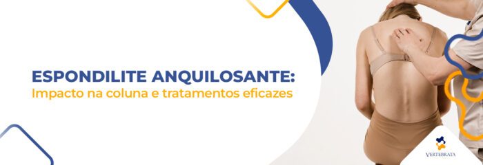 Espondilite anquilosante: Impacto na coluna e tratamentos eficazes
