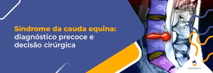 Síndrome da cauda equina: quando agir com urgência