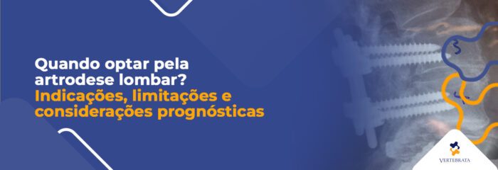 Quando optar pela artrodese lombar?