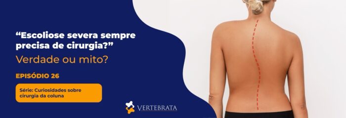 Série: Curiosidades sobre cirurgia da coluna Episódio 26 —   “Escoliose severa sempre precisa de cirurgia?”
