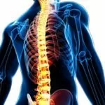 Conheça as principais doenças da coluna